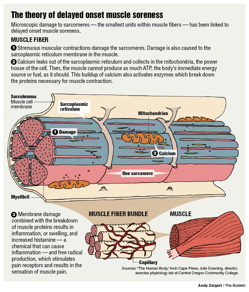 Why-Do-Muscles-Ache-After-Exercise